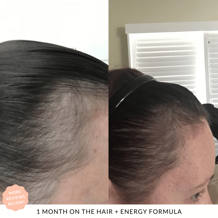 1 month results Hair + Energy JSHealth