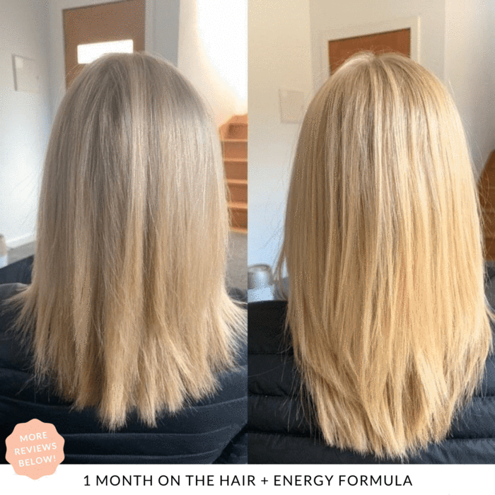 11 Best Hair Growth Vitamins And Supplements (2023) – Forbes Health