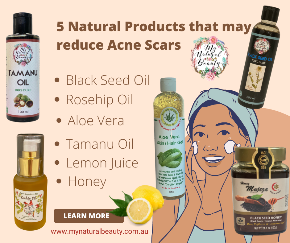 100% Pure Rosehip Oil- Organic – Unrefined- 50ml INGREDIENTS- 100% PURE Organic Rosehip Oil Australia. Reduce acne scars. Natural products to reduce acne scars.