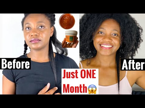 T444z for Hair Growth, Dandruff. Find out how the 2 month Hair Growth Challenge is going with Pamarow Naturals.