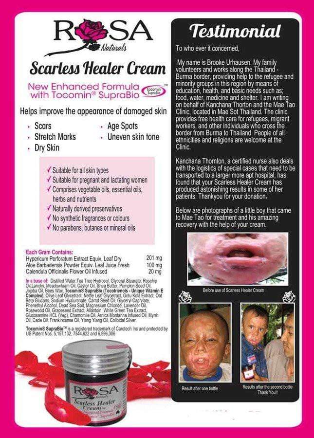 Rosa scarless healer cream testimonials. Burns, scars, age spots. Damaged skin. Buy online Sydney Australia.